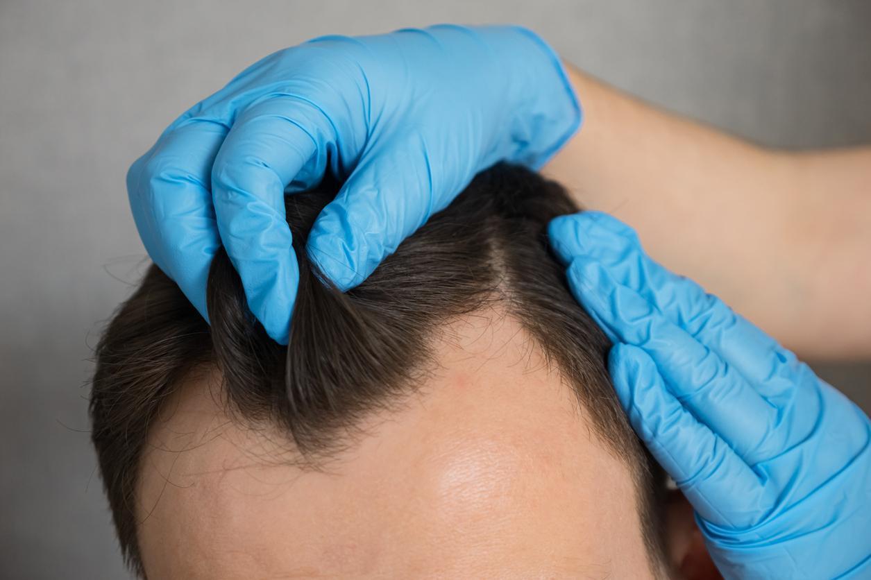 Truques para disfarçar falhas no cabelo