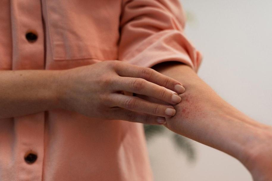Coceira que não passa e nariz entupido: sinais de que seu corpo pode estar enfrentando a inflamação tipo 2