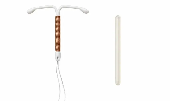 DIU e Implanon®: o que muda entre os contraceptivos de longa duração?